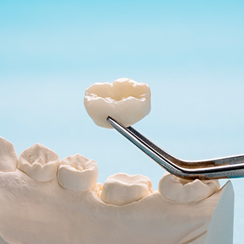 院内併設の歯科技工所