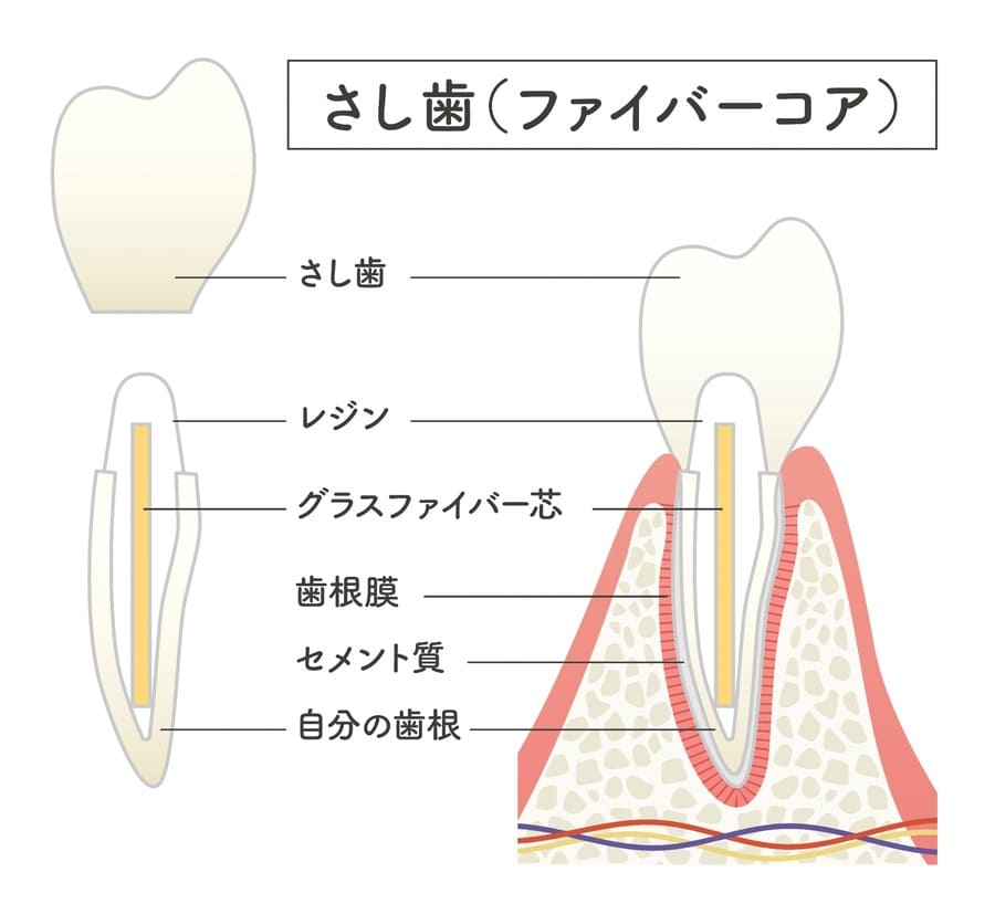 ファイバーコア