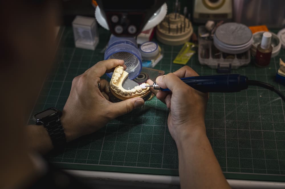 技工物の作製